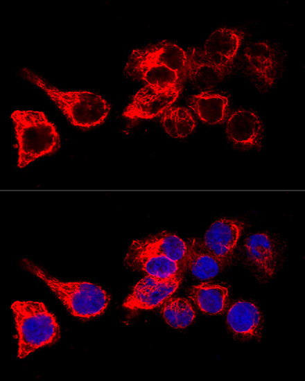 Cytokeratin 17 (KRT17) Rabbit Polyclonal Antibody - Image 3