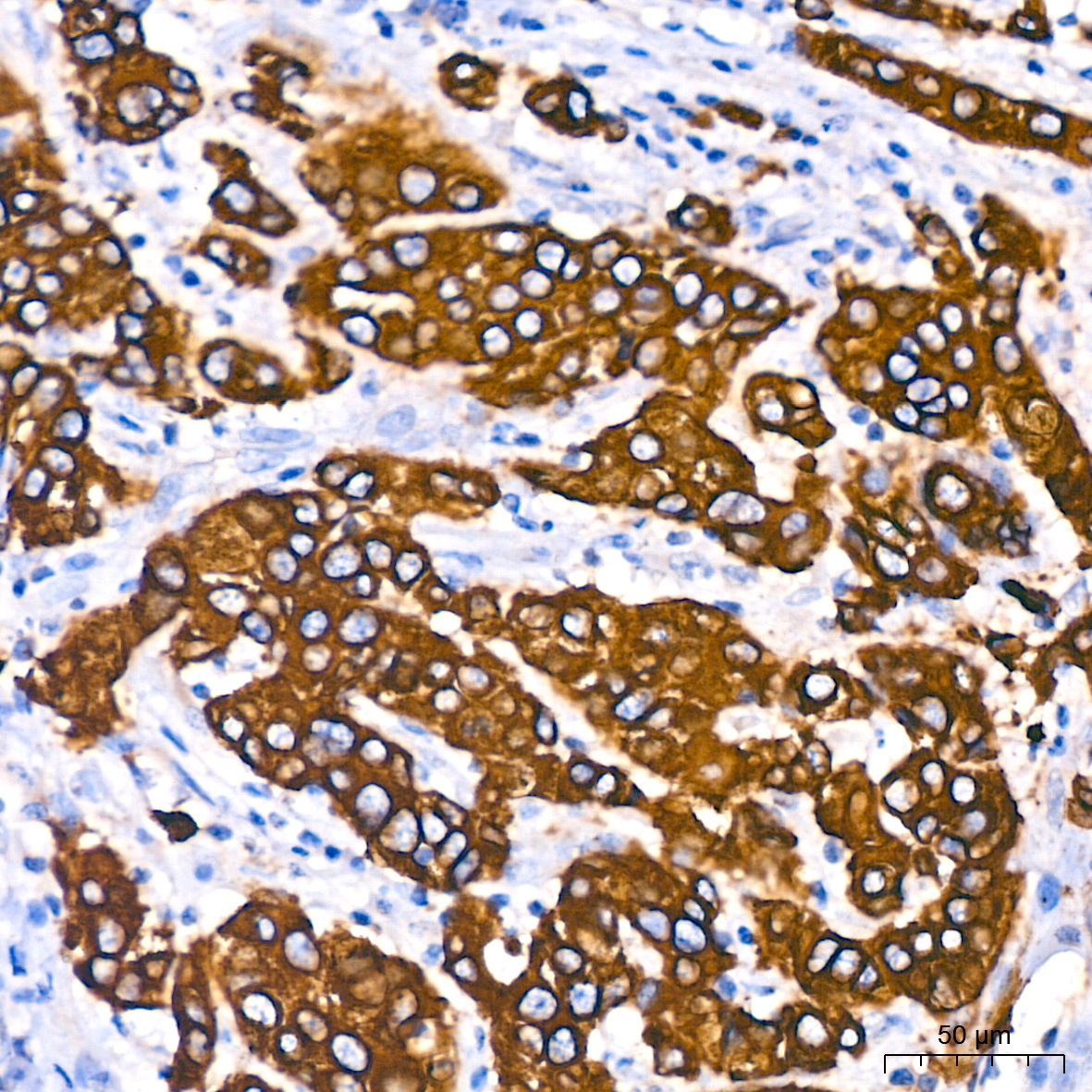 Cytokeratin 18 (KRT18) Rabbit Monoclonal Antibody - Image 2