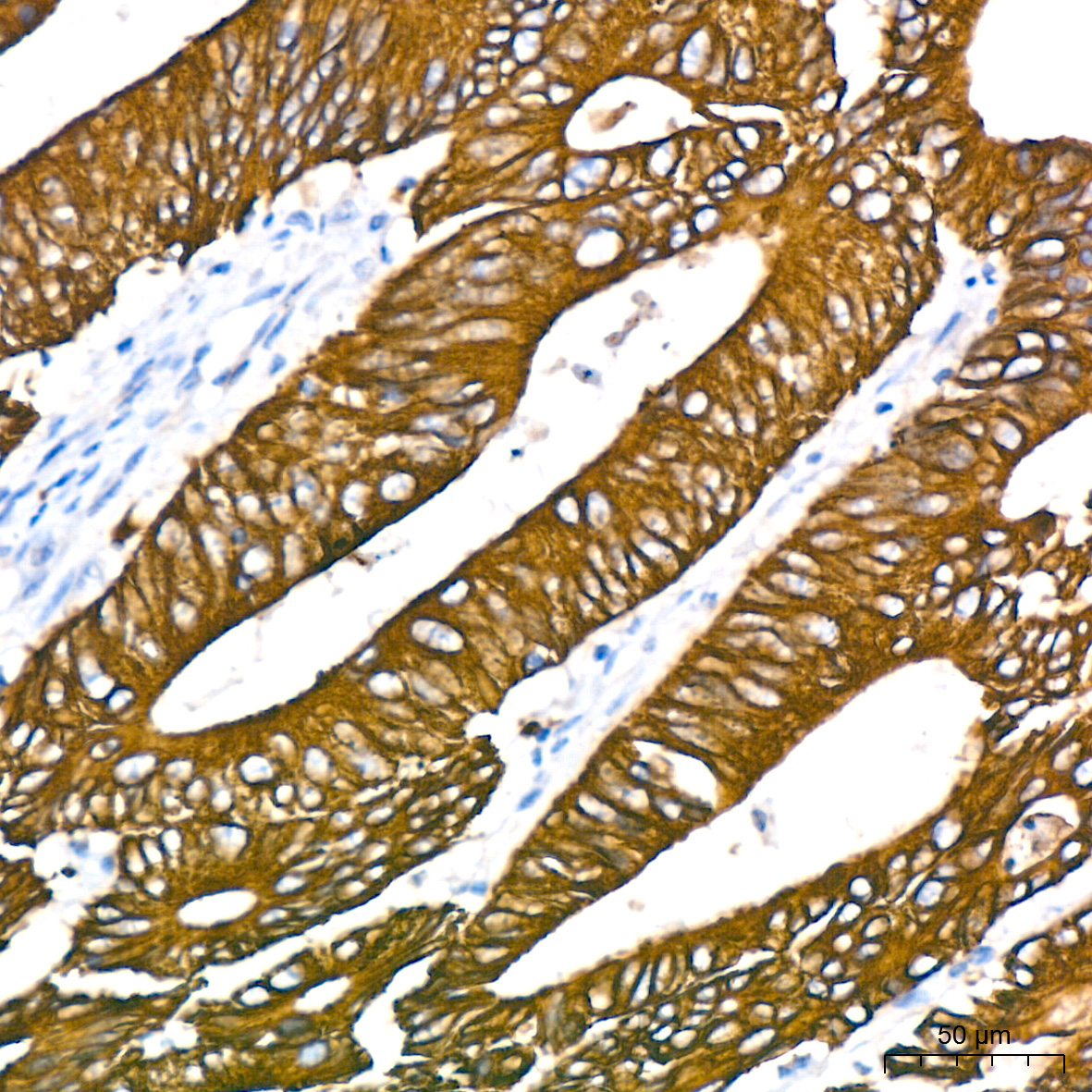Cytokeratin 18 (KRT18) Rabbit Monoclonal Antibody - Image 3