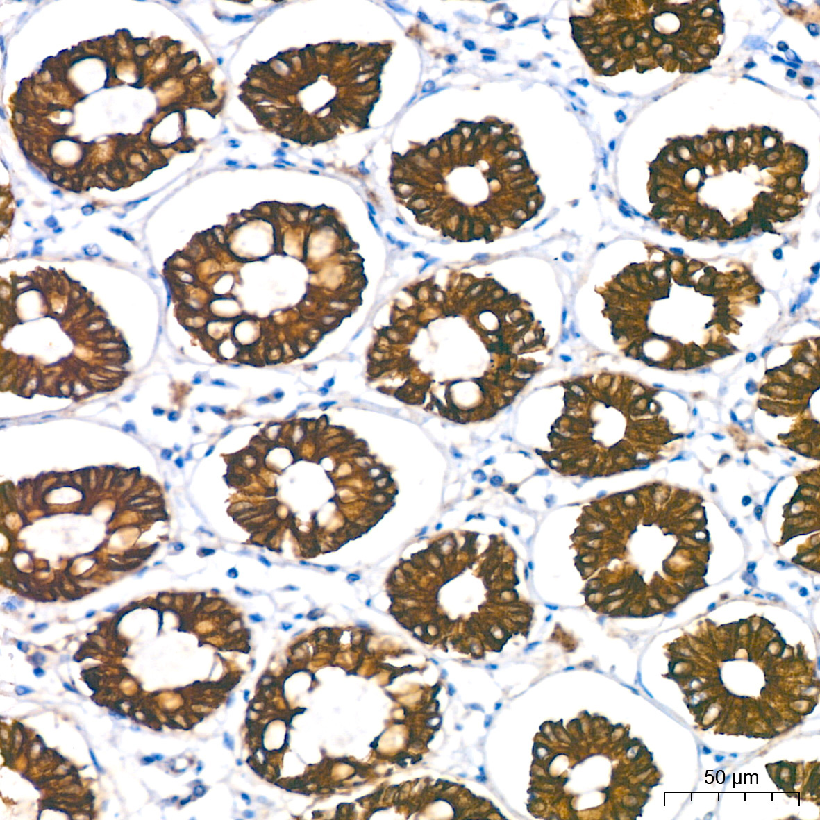 Cytokeratin 18 (KRT18) Rabbit Monoclonal Antibody - Image 4
