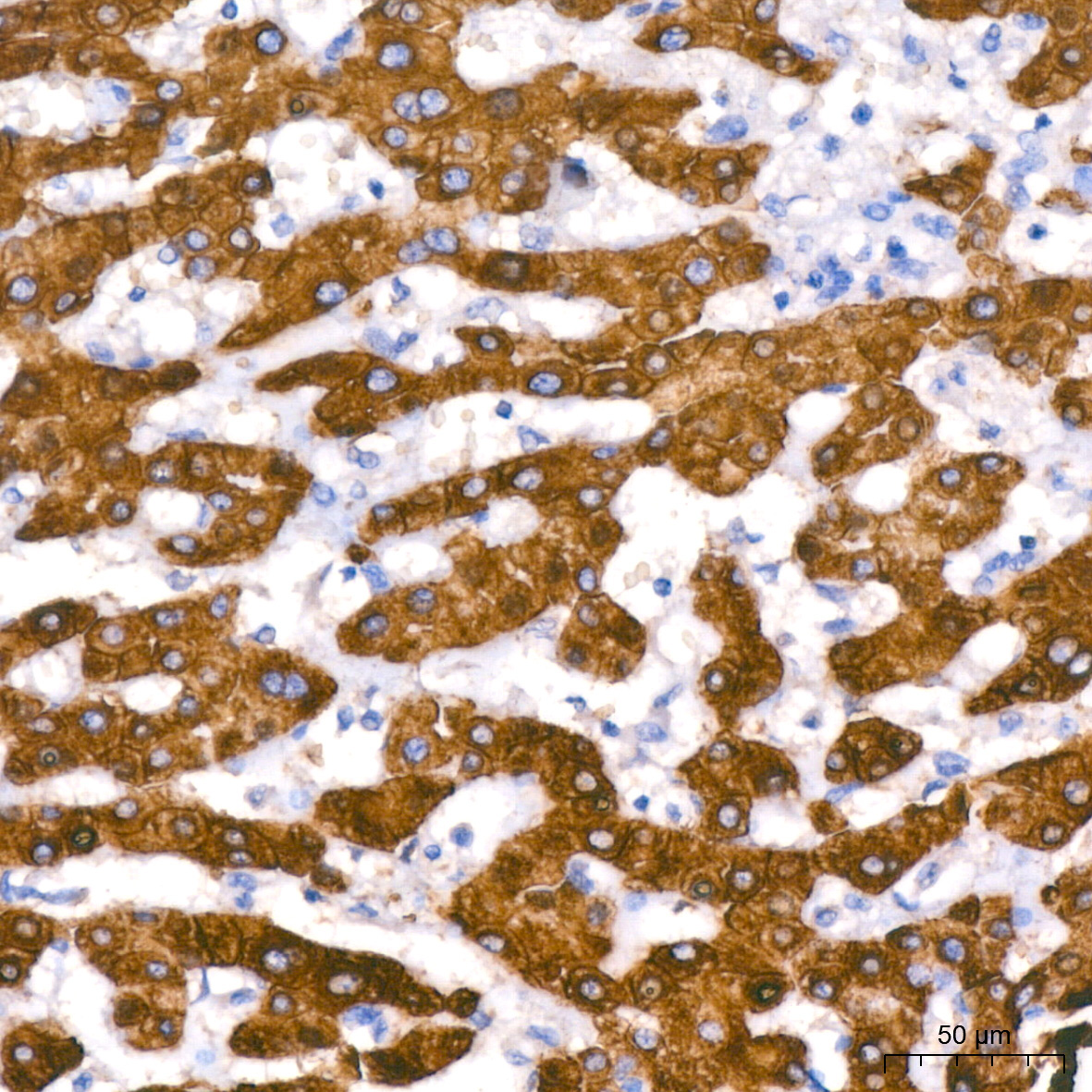 Cytokeratin 18 (KRT18) Rabbit Monoclonal Antibody - Image 5