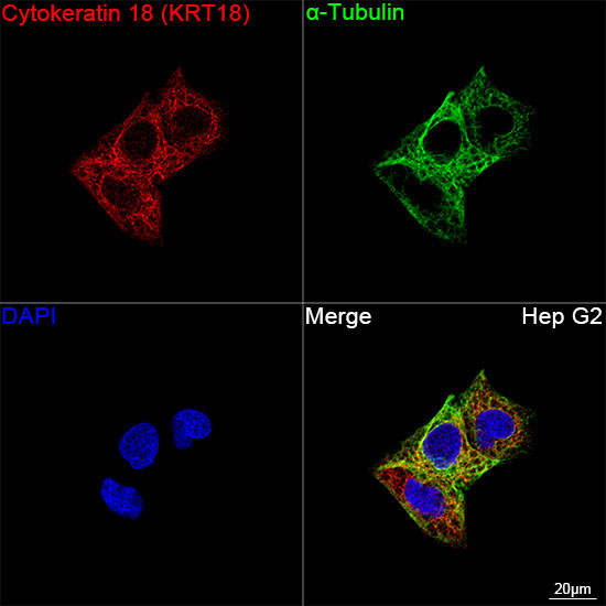 Cytokeratin 18 (KRT18) Rabbit Monoclonal Antibody - Image 6