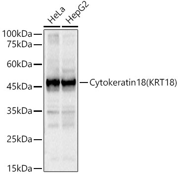 Cytokeratin 18 (KRT18) Rabbit Polyclonal Antibody