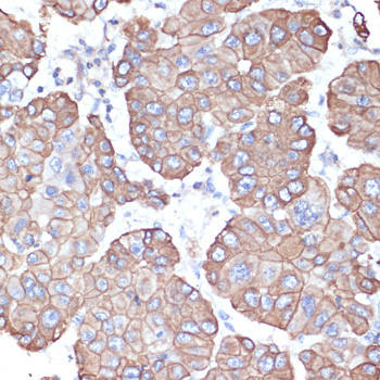 Cytokeratin 18 (KRT18) Rabbit Polyclonal Antibody - Image 2
