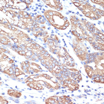 Cytokeratin 18 (KRT18) Rabbit Polyclonal Antibody - Image 3