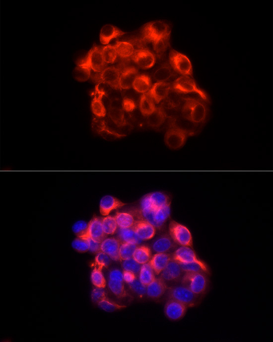 Cytokeratin 18 (KRT18) Rabbit Polyclonal Antibody - Image 4