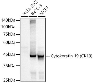 Cytokeratin 19 (CK19) Rabbit Monoclonal Antibody