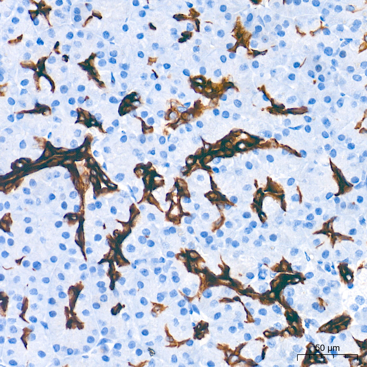Cytokeratin 19 (CK19) Rabbit Monoclonal Antibody - Image 2