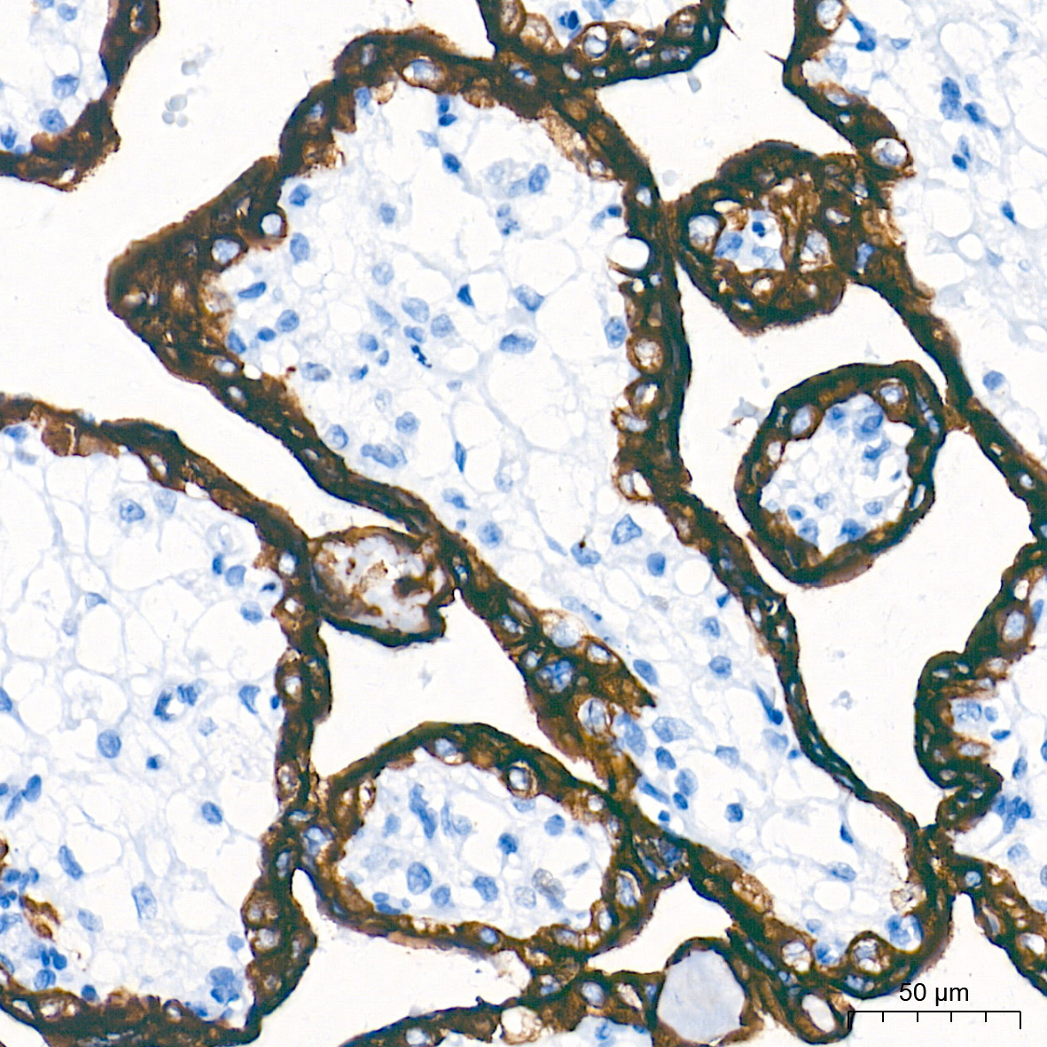 Cytokeratin 19 (CK19) Rabbit Monoclonal Antibody - Image 3