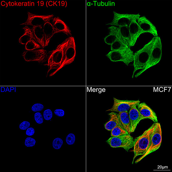 Cytokeratin 19 (CK19) Rabbit Monoclonal Antibody - Image 4