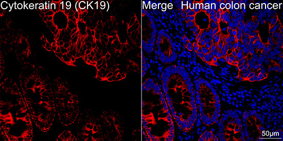 Cytokeratin 19 (CK19) Rabbit Monoclonal Antibody - Image 5