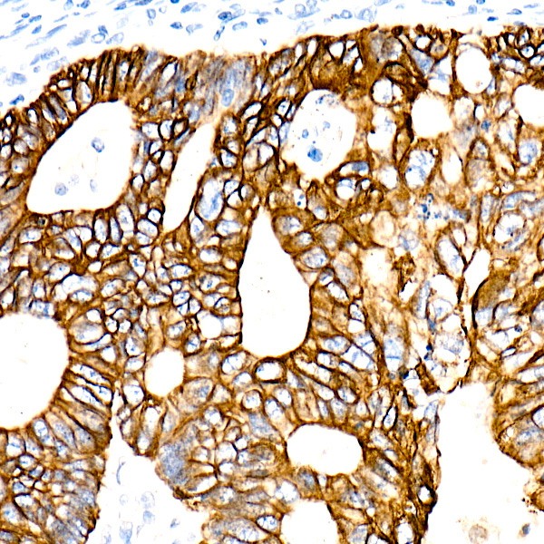 Cytokeratin 19 (KRT19) Rabbit Monoclonal Antibody
