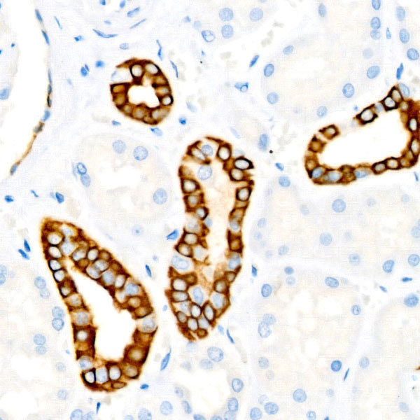 Cytokeratin 19 (KRT19) Rabbit Monoclonal Antibody - Image 2