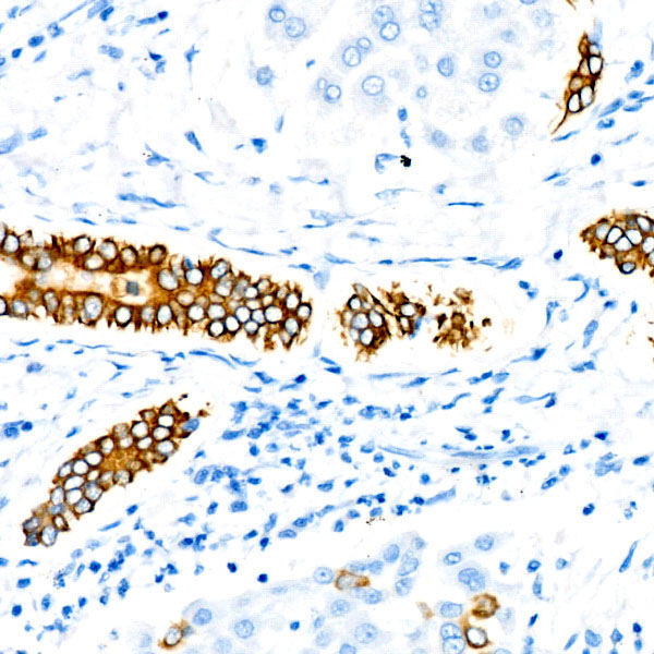 Cytokeratin 19 (KRT19) Rabbit Monoclonal Antibody - Image 3