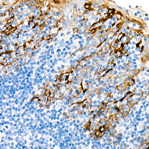 Cytokeratin 19 (KRT19) Rabbit Monoclonal Antibody - Image 4