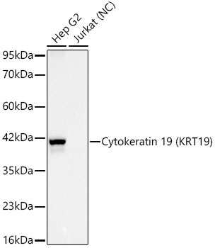 Cytokeratin 19 (KRT19) Rabbit Monoclonal Antibody