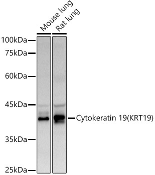 Cytokeratin 19 (KRT19) Rabbit Polyclonal Antibody