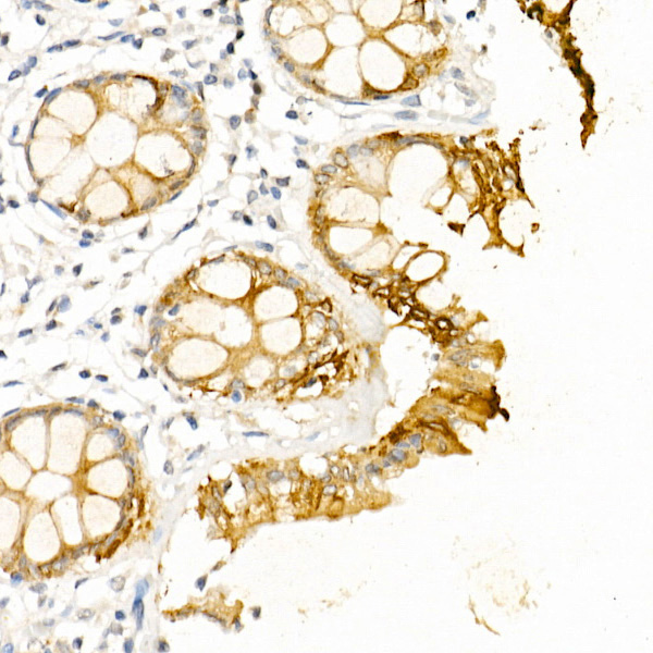 Cytokeratin 19 (KRT19) Rabbit Polyclonal Antibody - Image 2