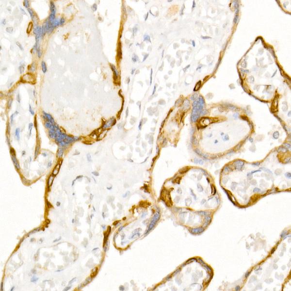 Cytokeratin 19 (KRT19) Rabbit Polyclonal Antibody - Image 3