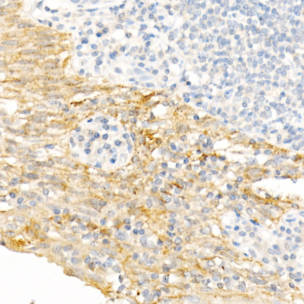 Cytokeratin 19 (KRT19) Rabbit Polyclonal Antibody - Image 4