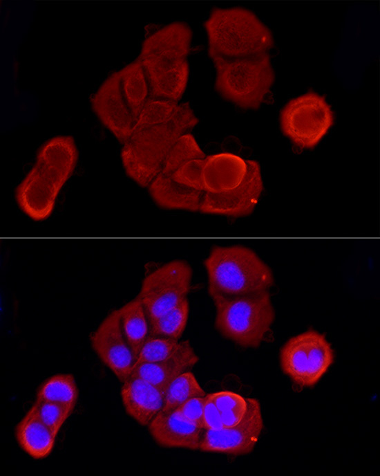 Cytokeratin 19 (KRT19) Rabbit Polyclonal Antibody - Image 5