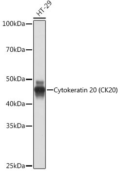 Cytokeratin 20 (CK20) Rabbit Monoclonal Antibody