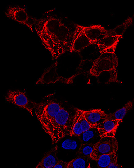 Cytokeratin 20 (KRT20) Rabbit Polyclonal Antibody