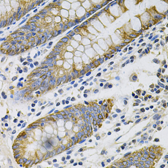 Cytokeratin 20 (KRT20) Rabbit Polyclonal Antibody - Image 2
