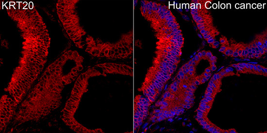 Cytokeratin 20 (KRT20) Rabbit Polyclonal Antibody - Image 3