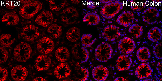 Cytokeratin 20 (KRT20) Rabbit Polyclonal Antibody - Image 4