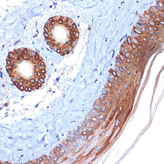 Cytokeratin 2e (KRT2) Rabbit Monoclonal Antibody - Image 2