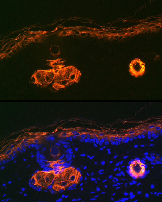 Cytokeratin 2e (KRT2) Rabbit Monoclonal Antibody - Image 3