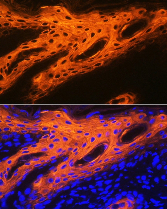Cytokeratin 2e (KRT2) Rabbit Monoclonal Antibody - Image 4
