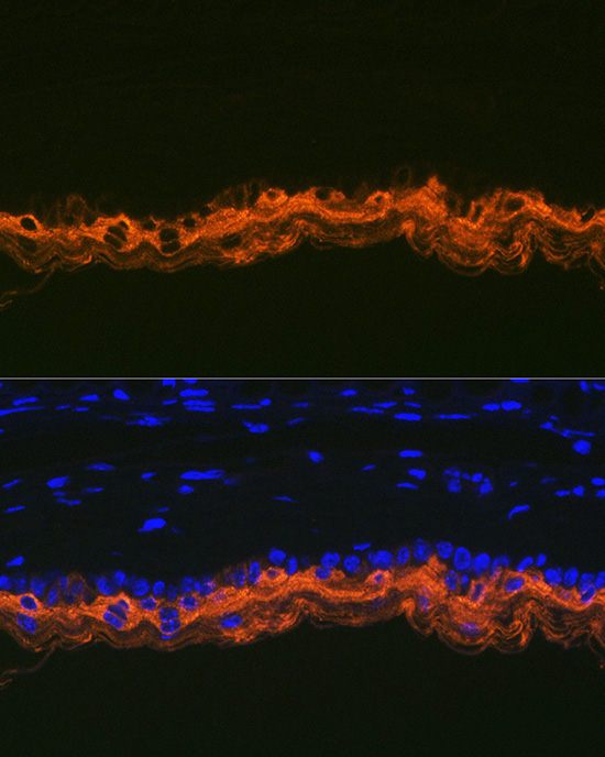 Cytokeratin 2e (KRT2) Rabbit Monoclonal Antibody - Image 5