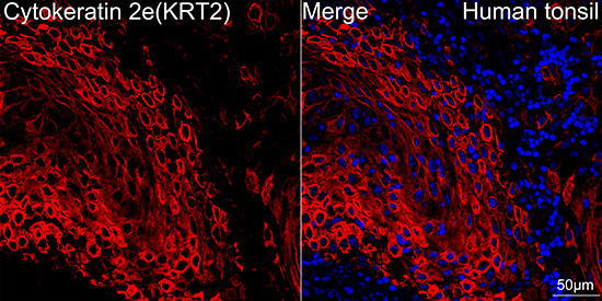 Cytokeratin 2e (KRT2) Rabbit Monoclonal Antibody - Image 6