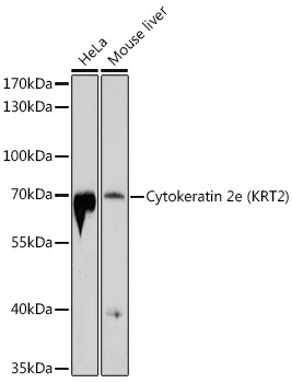 Cytokeratin 2e (KRT2) Rabbit Polyclonal Antibody