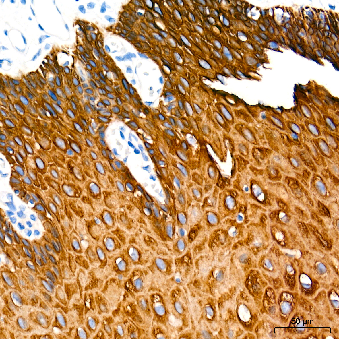 Cytokeratin 4 (KRT4) Rabbit Monoclonal Antibody - Image 2