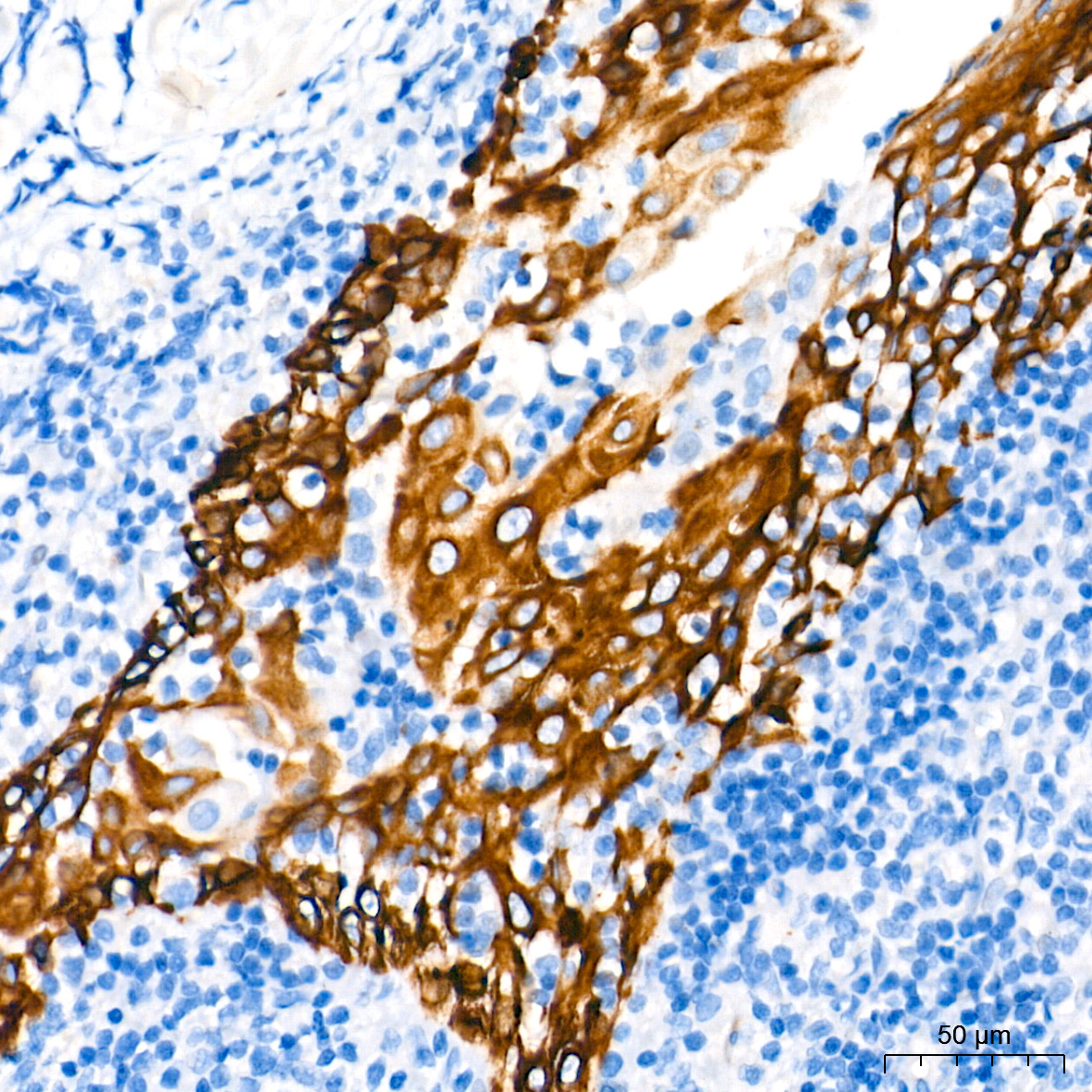 Cytokeratin 4 (KRT4) Rabbit Monoclonal Antibody - Image 3