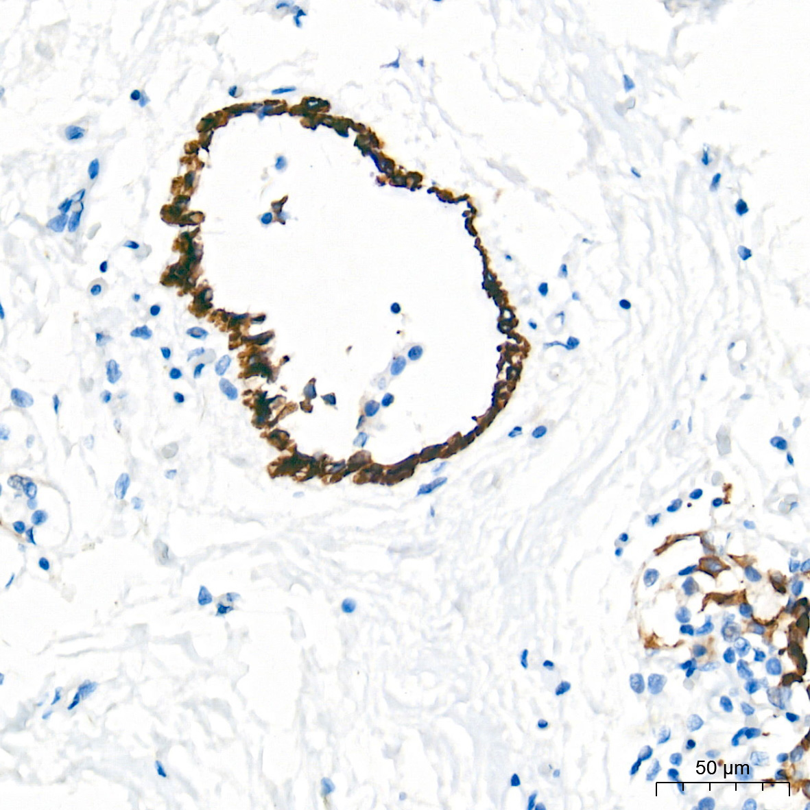 Cytokeratin 4 (KRT4) Rabbit Monoclonal Antibody - Image 4
