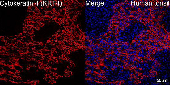 Cytokeratin 4 (KRT4) Rabbit Monoclonal Antibody - Image 5