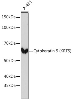 Cytokeratin 5 Rabbit Monoclonal Antibody