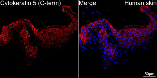 Cytokeratin 5 Rabbit Monoclonal Antibody - Image 2