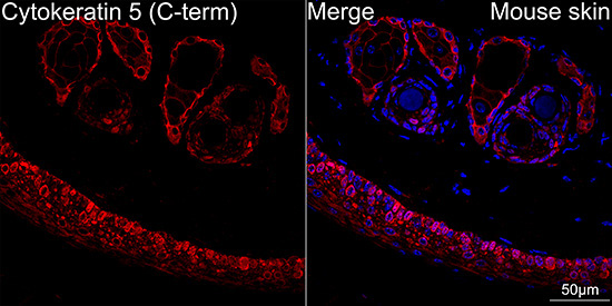 Cytokeratin 5 Rabbit Monoclonal Antibody - Image 3