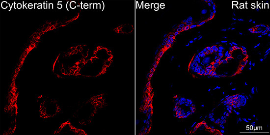Cytokeratin 5 Rabbit Monoclonal Antibody - Image 4