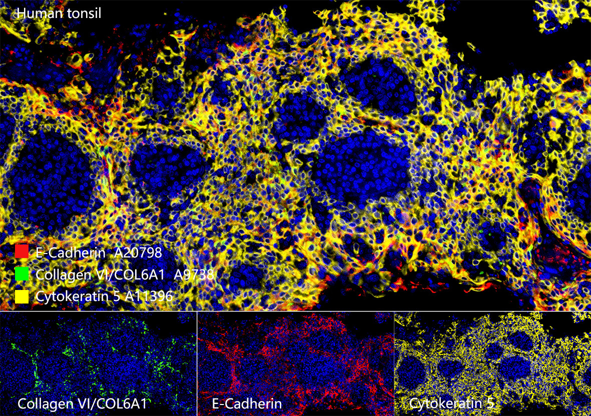 Cytokeratin 5 Rabbit Monoclonal Antibody - Image 5