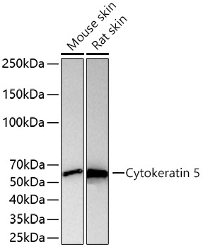 Cytokeratin 5 Rabbit Monoclonal Antibody - Image 6