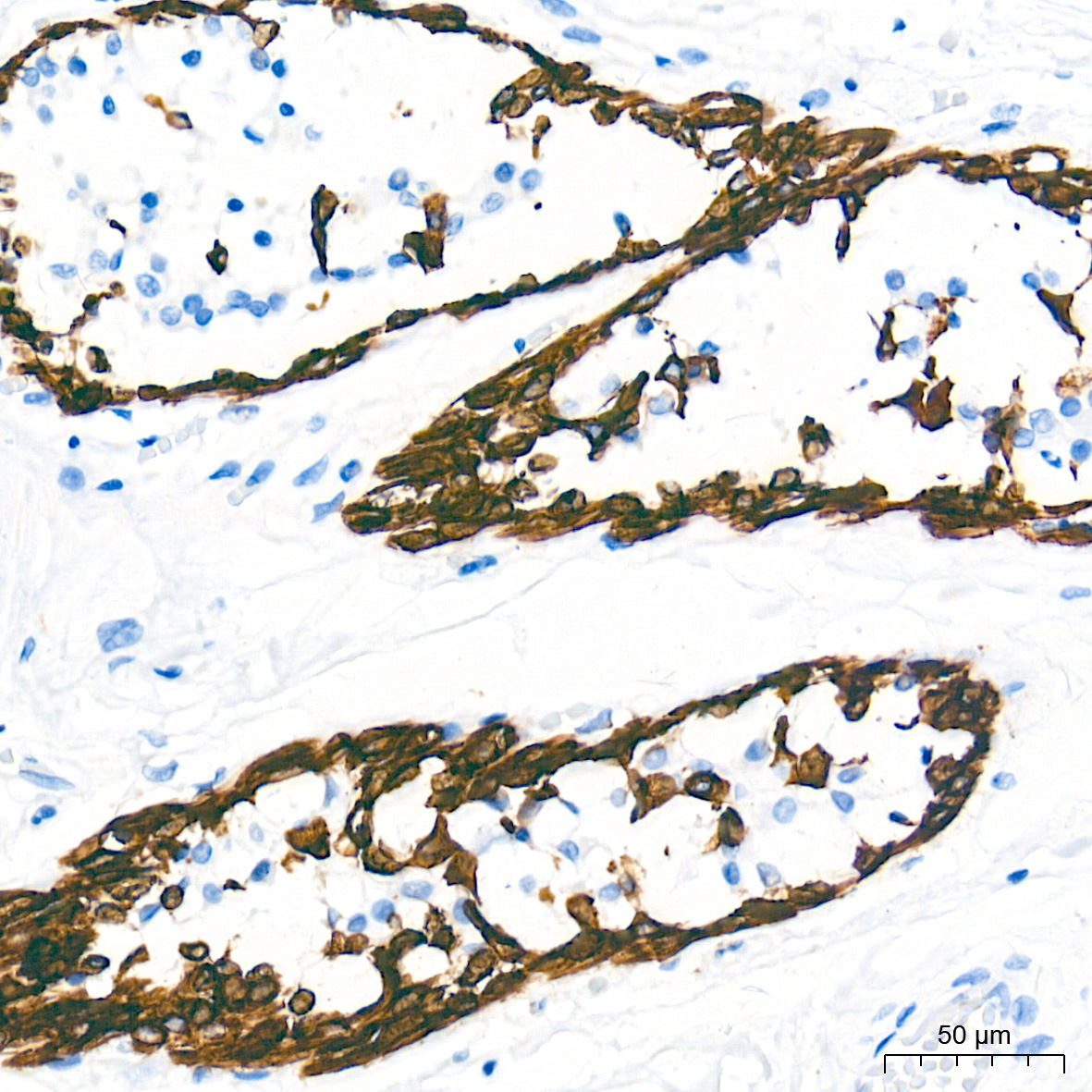 Cytokeratin 5 Rabbit Monoclonal Antibody - Image 7