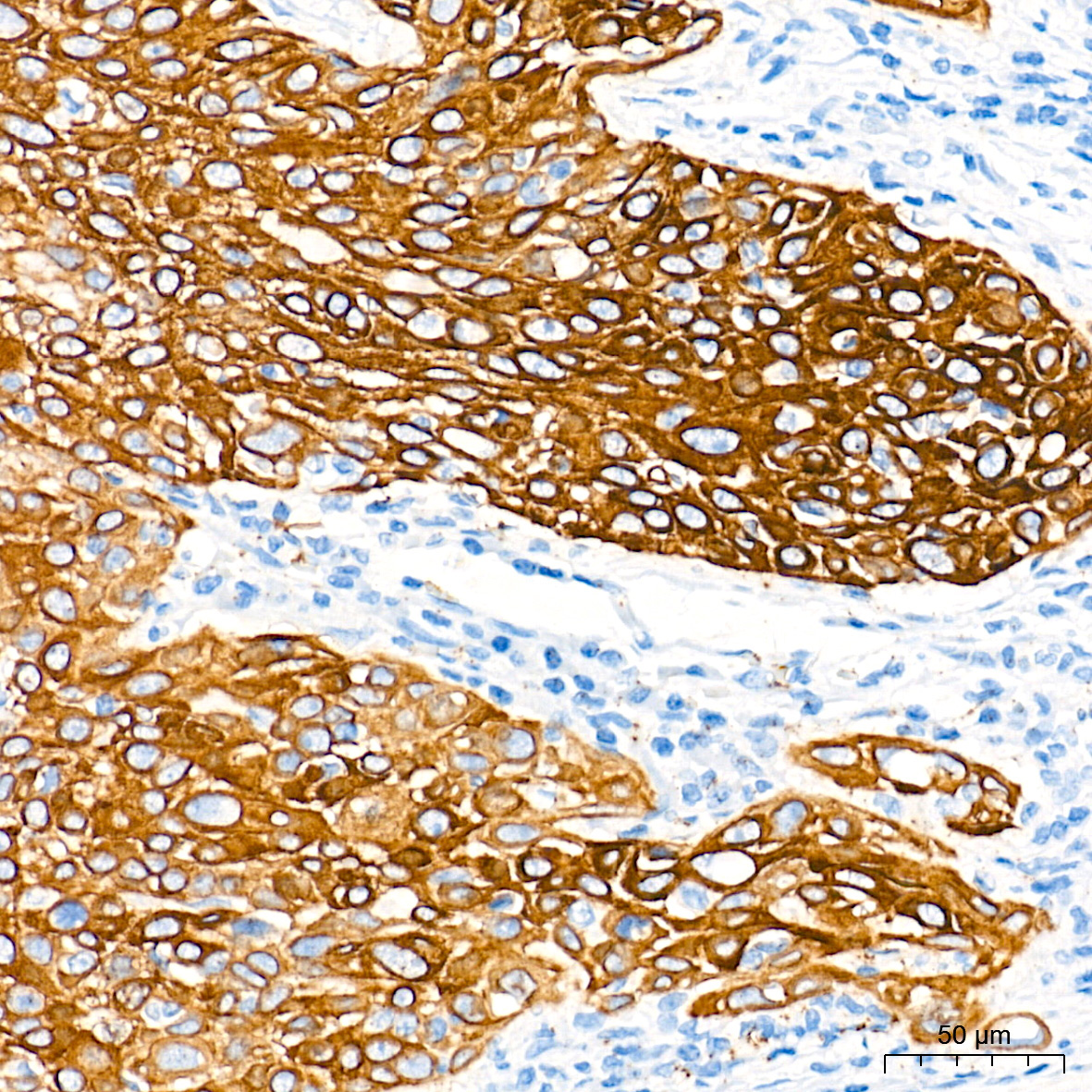 Cytokeratin 5 Rabbit Monoclonal Antibody - Image 8
