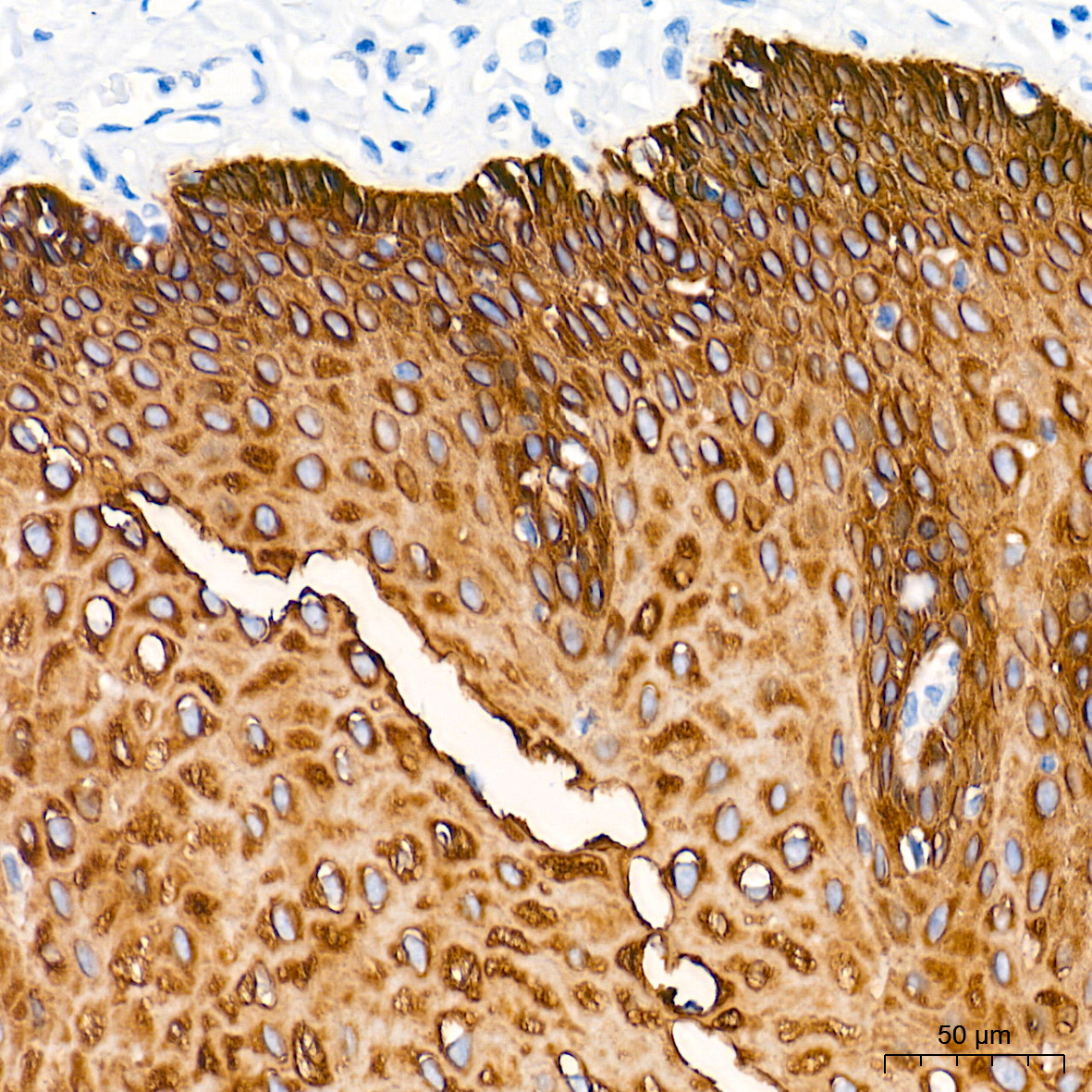 Cytokeratin 5 Rabbit Monoclonal Antibody - Image 9