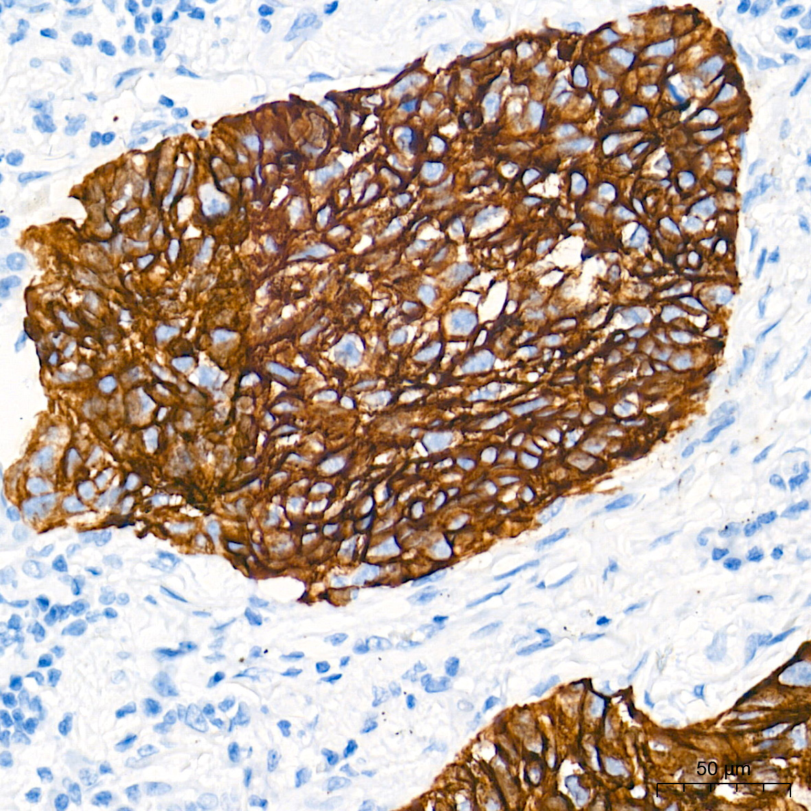 Cytokeratin 5 Rabbit Monoclonal Antibody - Image 10